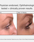 Nu-Cil Before and after