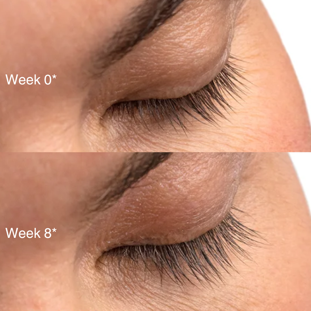 Obagi Nu-Cil eye lash growth