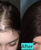 XCellarisPRO Hair Treatment  before and after